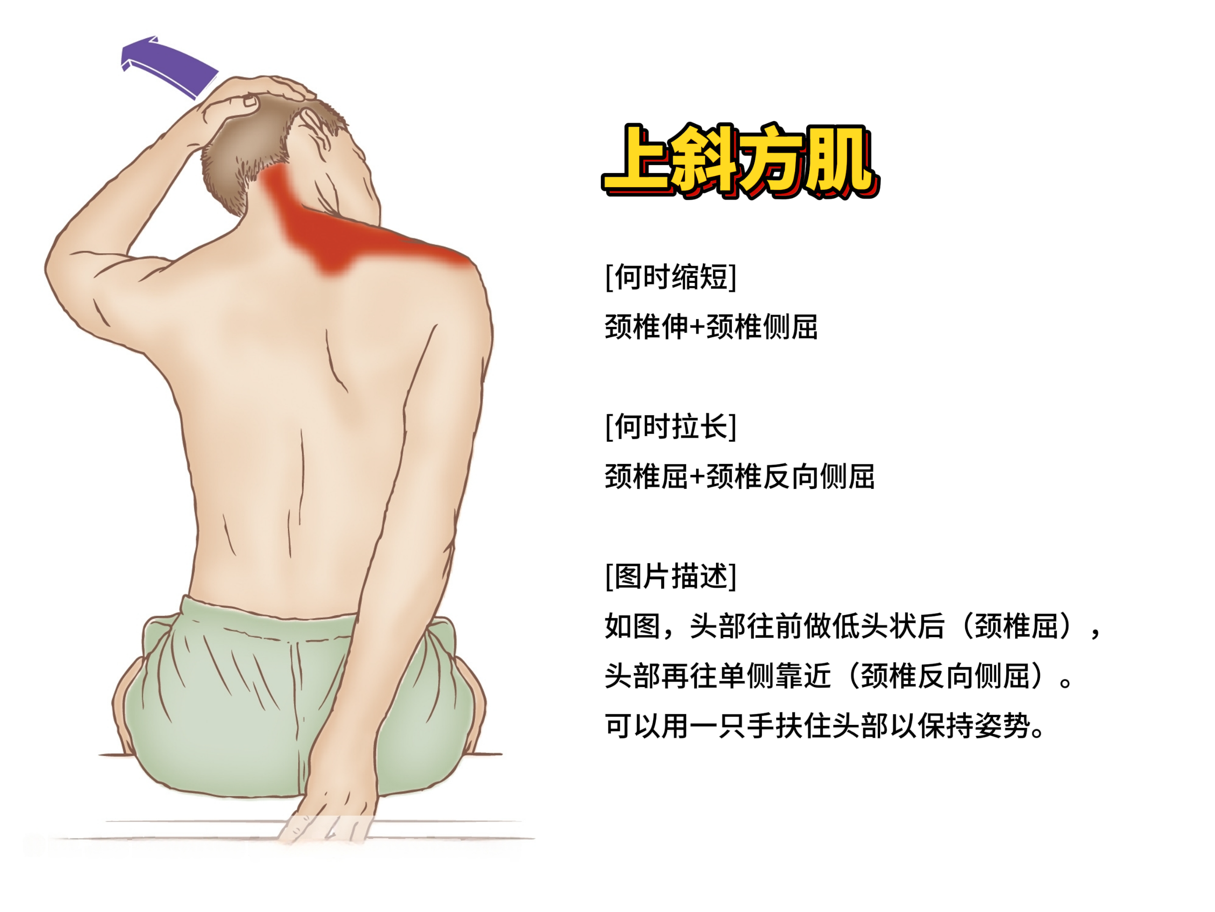 上斜方